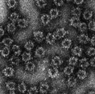 E型肝炎ウイルス